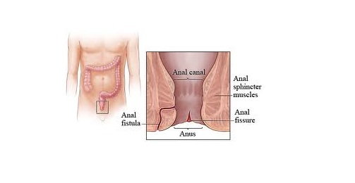 Anal itching clear discharge